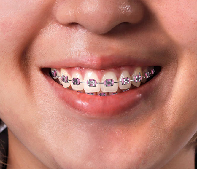 orthodontie centre dentaire carouge
